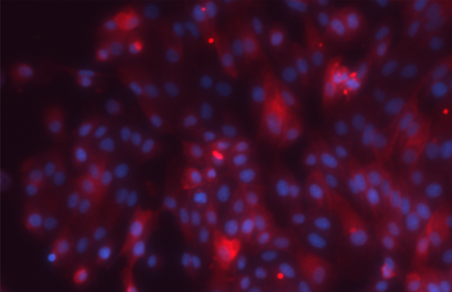 Red and purple renal proximal tubular epithelial cells.