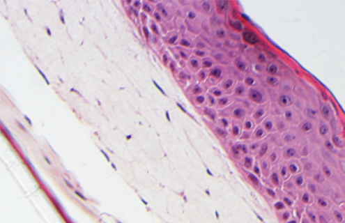 Pink foreskin keratinocyte cells.