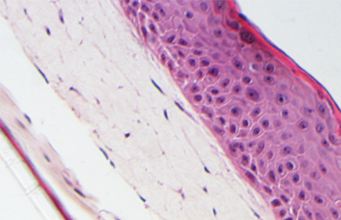 keratinocyte histology