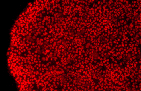 Red IPSC colony nanog cells.