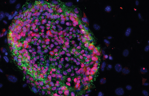 Purple and green induced pluripotent stem cells.