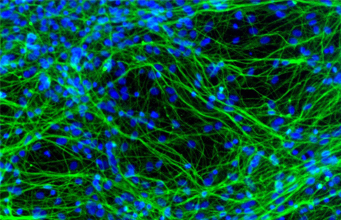 Neurons derived from human neural stem cells.
