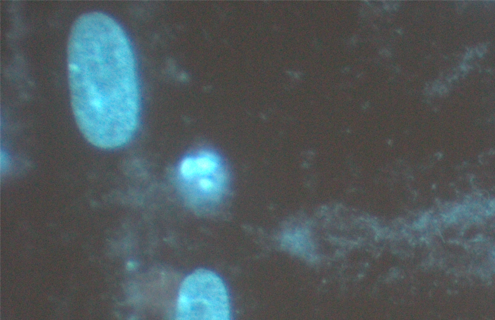 Blue mycoplasma cells.