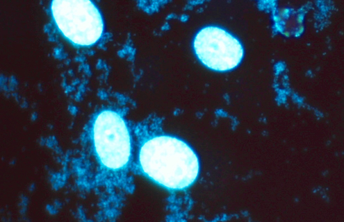 Blue m-hyorhinis mycoplasma cells.