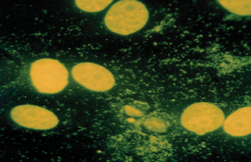 Flat, fluorescent yellow mycoplasma spheres.