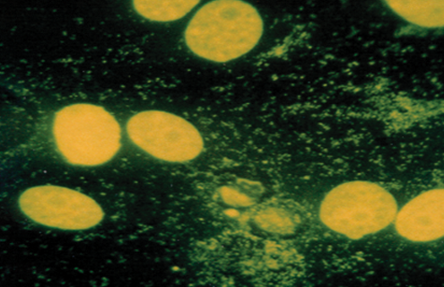 mycoplasma cell culture