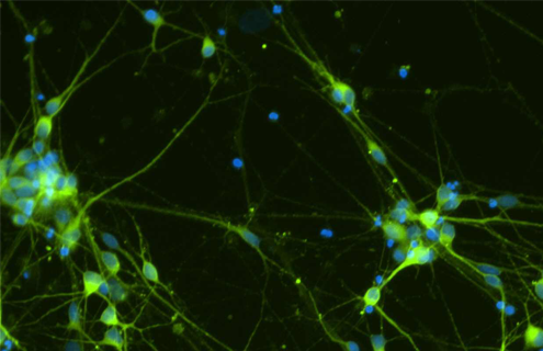 Green and blue dopaminergic Diff Tuj1 DAPI cells.