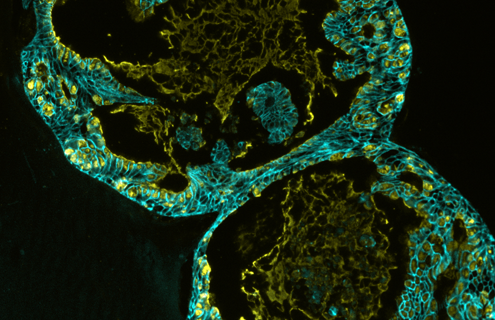 Green ECAD organoid cells.