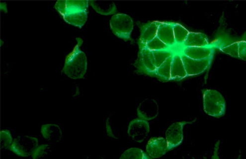 Green coronavirus using NCTC clone 929.