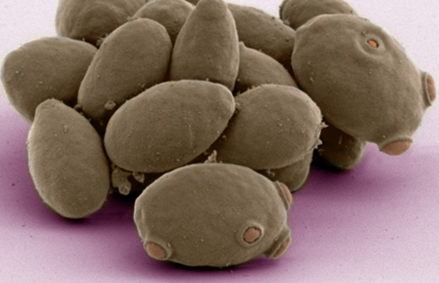 Purple saccharomyces cerevisiae yeast.