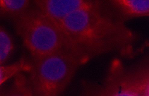 Blue and red mcf-7 human breast cells.