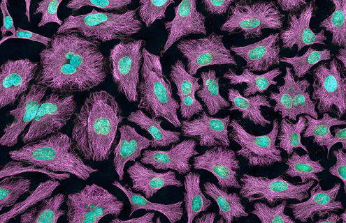 HeLa cells, purple, green and teal.