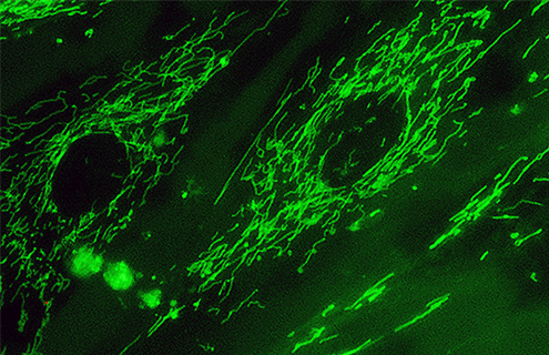 Green fluorescent mitochondria in 895 Sk cells.