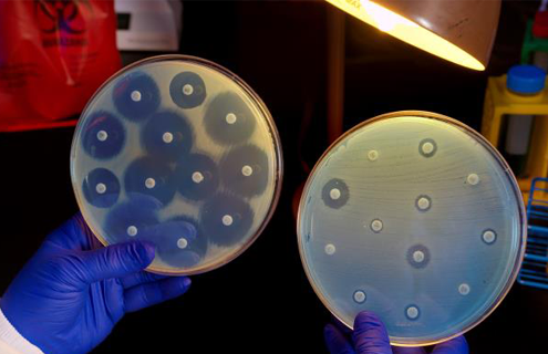 Blue-gloved hands, each holding a petri dish containing white carbapenem resistant, Enterobacteriaceae under an overhead lamp.