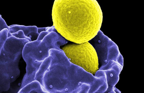 Yellow spheres of methicillin-resistant staphylococcus aureus.