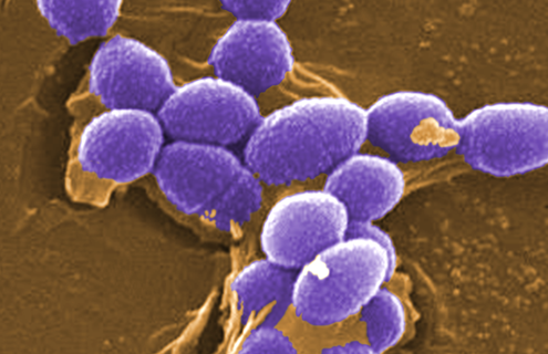 Purple spheres of Enterococcus faecalis bacteria.