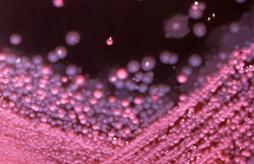 Tiny beads of pink and purple bacteria in MacConkey growth medium.