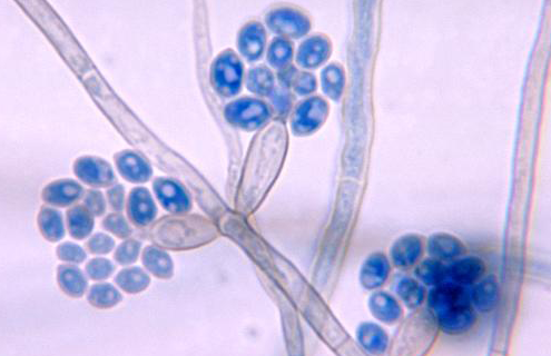 Translucent stems and blue, flower-like clusters of Exophiala salmonis.