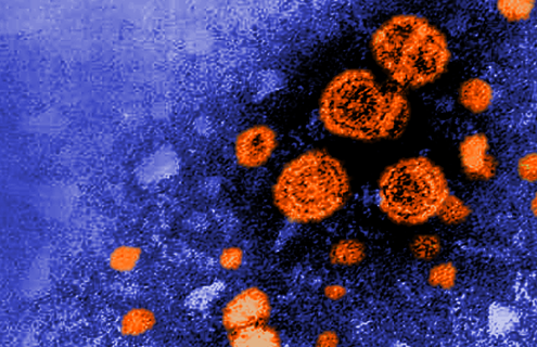 Grainy, blue and orange Hepatitis virus.