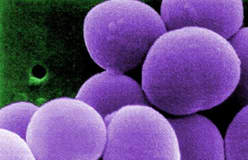 Round, purple, cluster of grape-like bacteria.