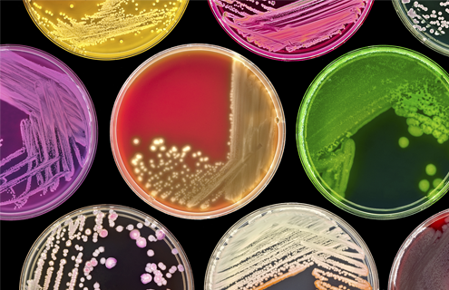 Petri dishes filled with bright-colored cells and media in different line and spot patterns.