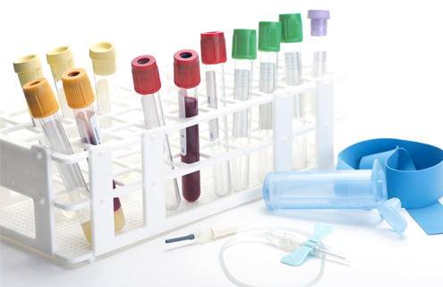 Test tubes with various colored caps in a stand, 2 of the test tubes filled with blood; syringe, tourniquet, and vial nearby.