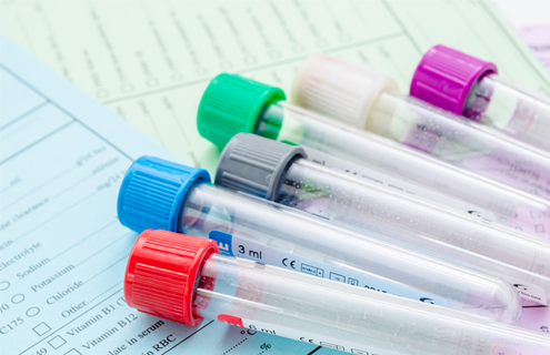 Empty test tubes with caps of various colors laying on top of medical forms.