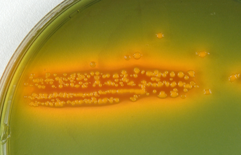 Petri dish culture of E coli bacteria.