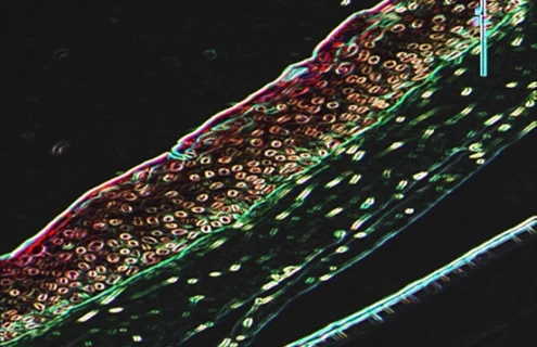 Fluorescent microscopy image of human skin cells expressing telomerase reverse transcriptase, showing layered cells in red, brown, and green against a dark backgroun