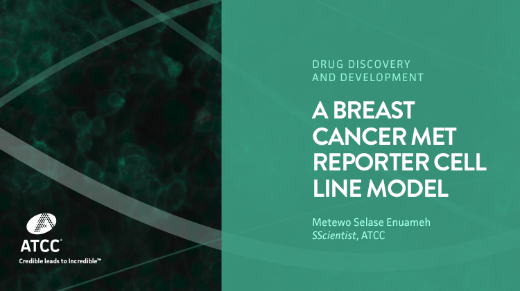 A Breast Cancer MET Reporter Cell Line Model