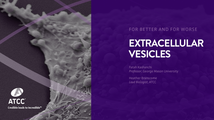 Extracellular Vesicles For Better and For Worse webinar overlay image