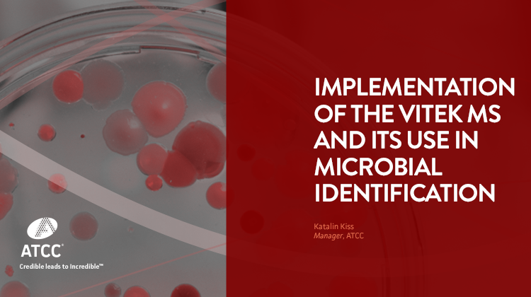 Implementation of the VITEK MS and its Use in Microbial Identification webinar video overlay