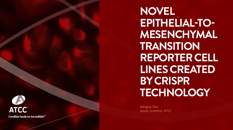 Novel Epithelial-to-Mesenchymal Transition Reporter Cell Lines Created by CRISPR Technology webinar overlay image