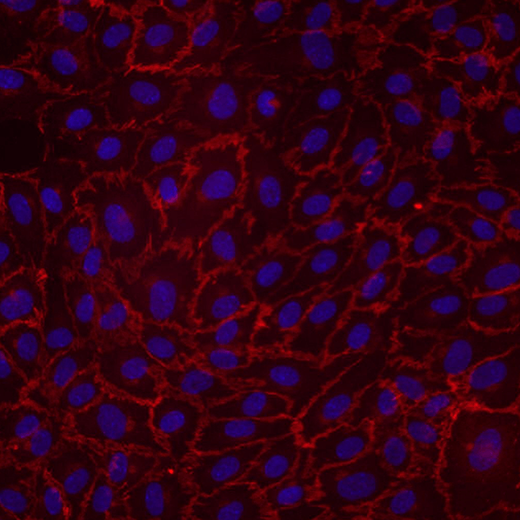 Purple, red and black human umbilical vein endothelial cells.