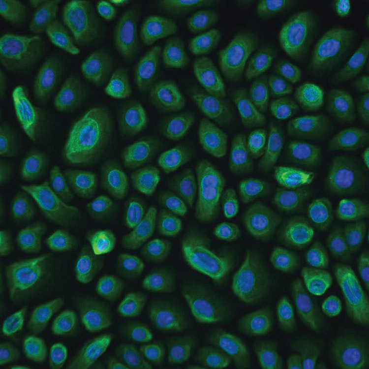 Green and blue NuLi lung epithelial small airway cells.