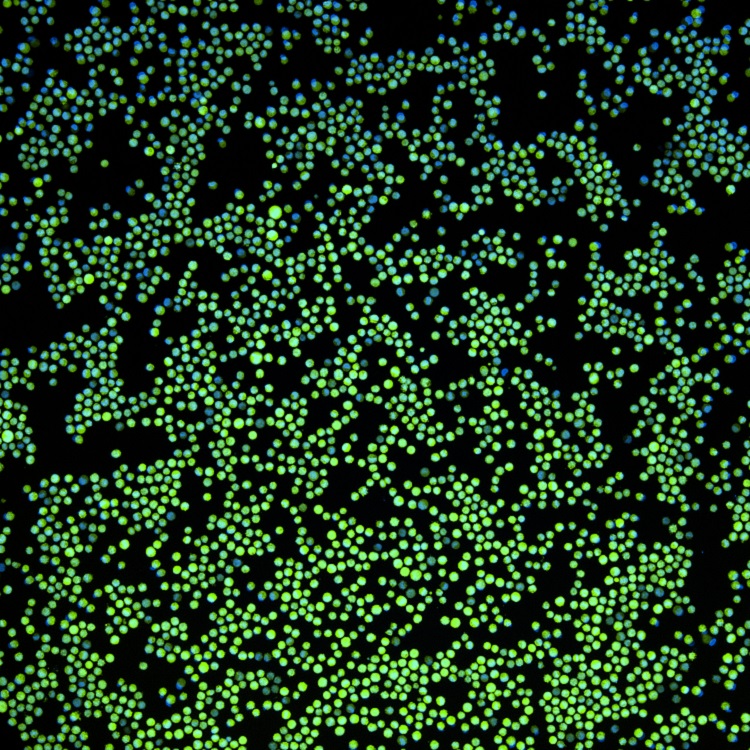 Green K562-GFP with nuclear stain.