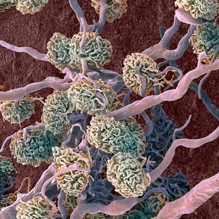 hTERT kidney renal proximal tubular epithelial cells.