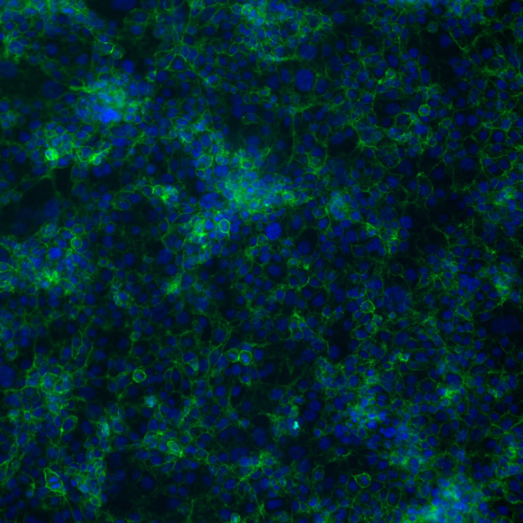 cells, demeth con, GFP, EMT-MET, Colon EMT, green, blue