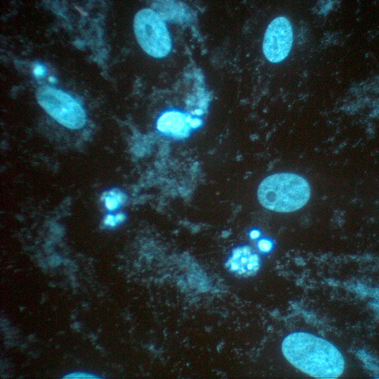 Blue mycoplasma cells.