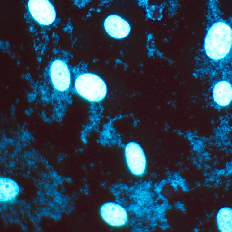 Blue m-hyorhinis mycoplasma cells.