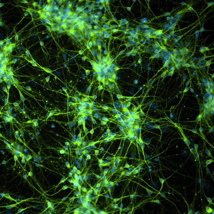 Green and blue dopaminergic neural progenitor cells