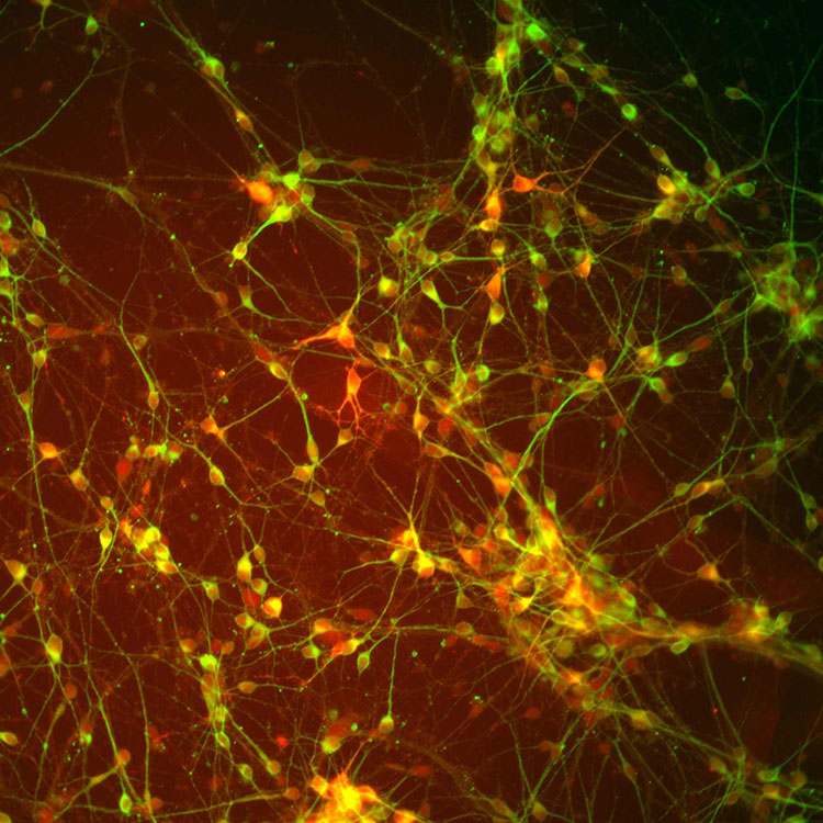 Green and red dopaminergic Diff Tuj1 DAPI cells.