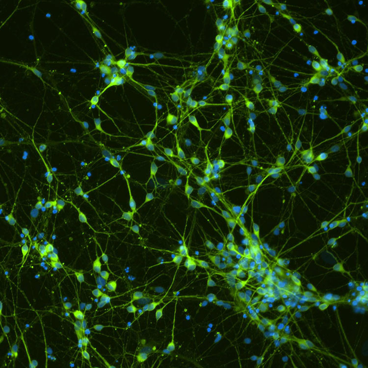 Green and blue dopaminergic Diff Tuj1 DAPI cells.