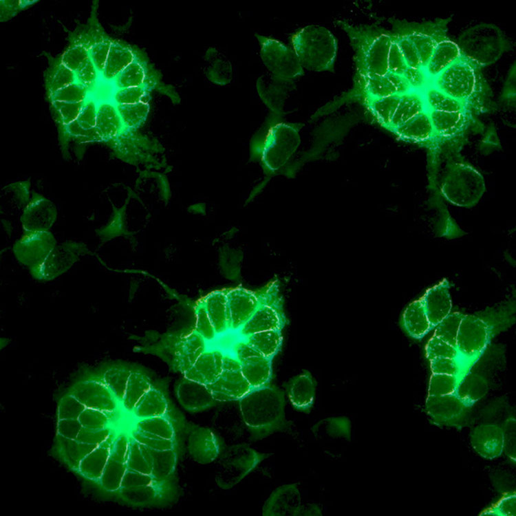 Green coronavirus using NCTC clone 929.