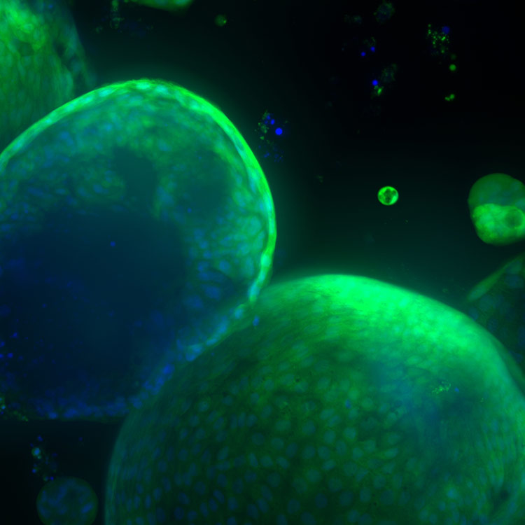 cells, organoid, ICC, 95636, AM, A01f03, green