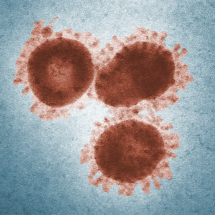 Coronavirus cells.