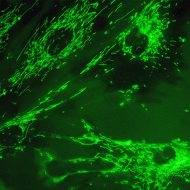 Green fluorescent mitochondria in 895 Sk cells.