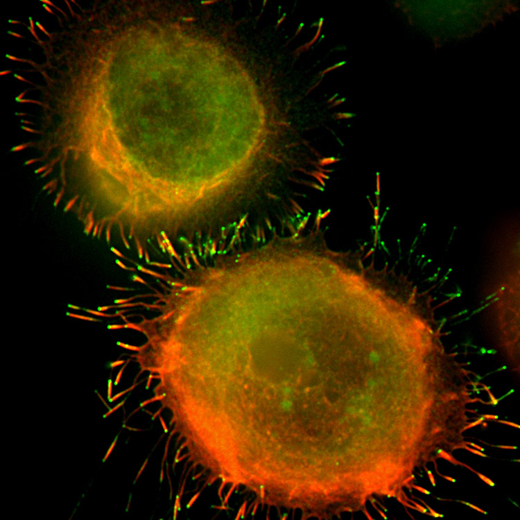 Orange and green K-562 bone marrow cells.