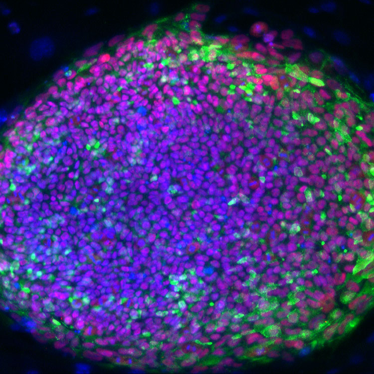 cells, ATCC, 24166, 58593, ascomycoteous fungi, mycrosporum gypseum, photo contest 11, Wenjun-Li