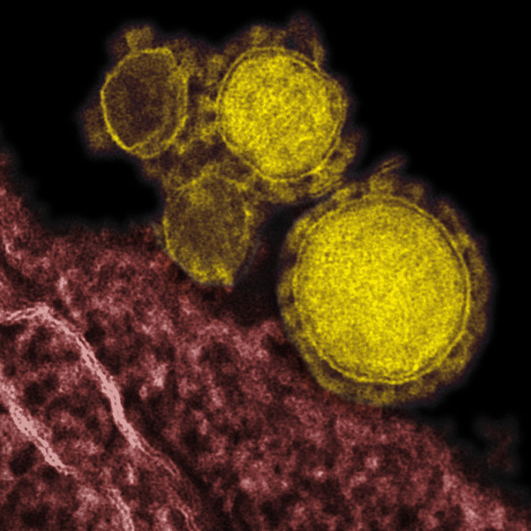Yellow and pink MERS CoV cells.